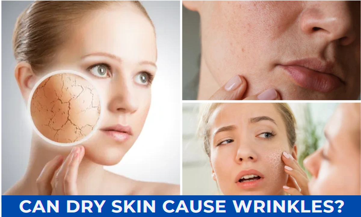 Can dry skin cause wrinkles? 6 Shocking Facts