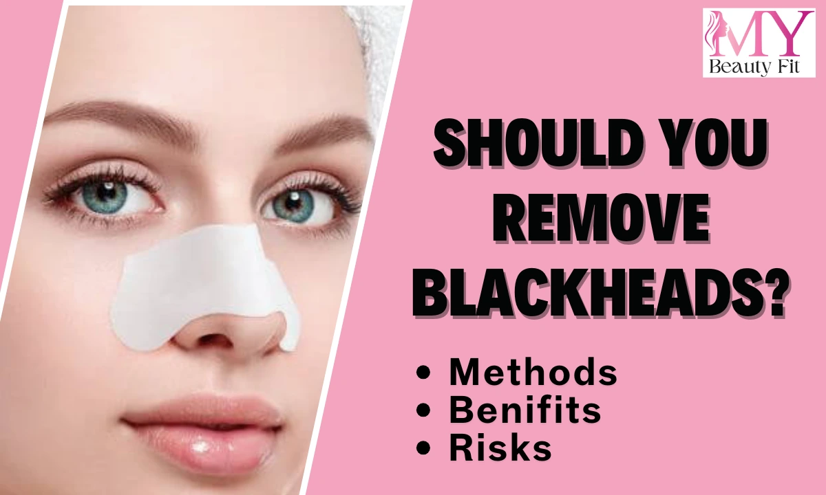 Should You Remove Blackheads? 5 Quick Insights