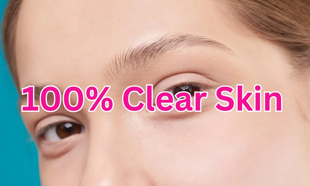 "How to Get 100% Clear Skin?