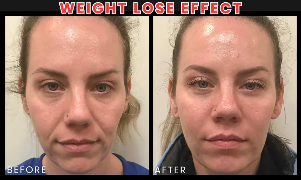 How Does Weight Loss Affect Your Face? 6 Unexpected Effects