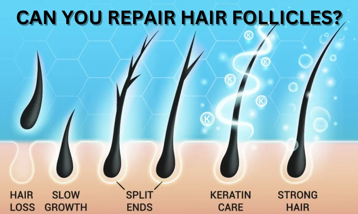 Can You Repair Hair Follicles? Discover the 5 Best Treatments