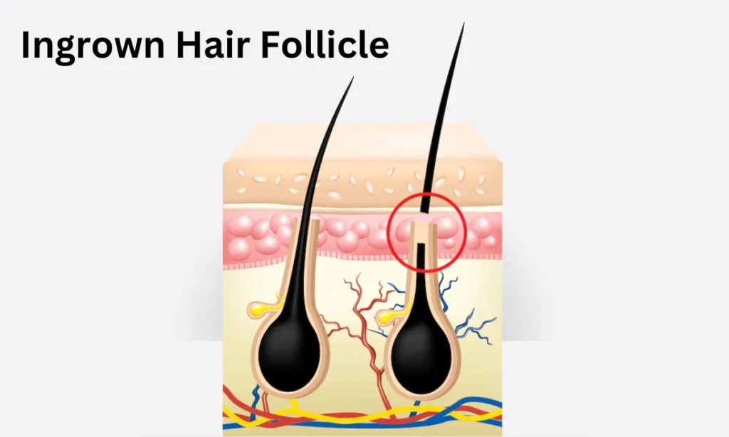 Can You Repair Hair Follicles? Discover the 5 Best Treatments