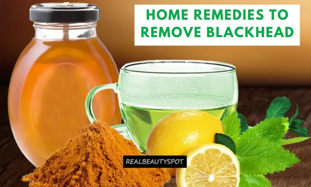 How to Remove Blackheads Permanently: 3 Surprising Solutions You Need to Try