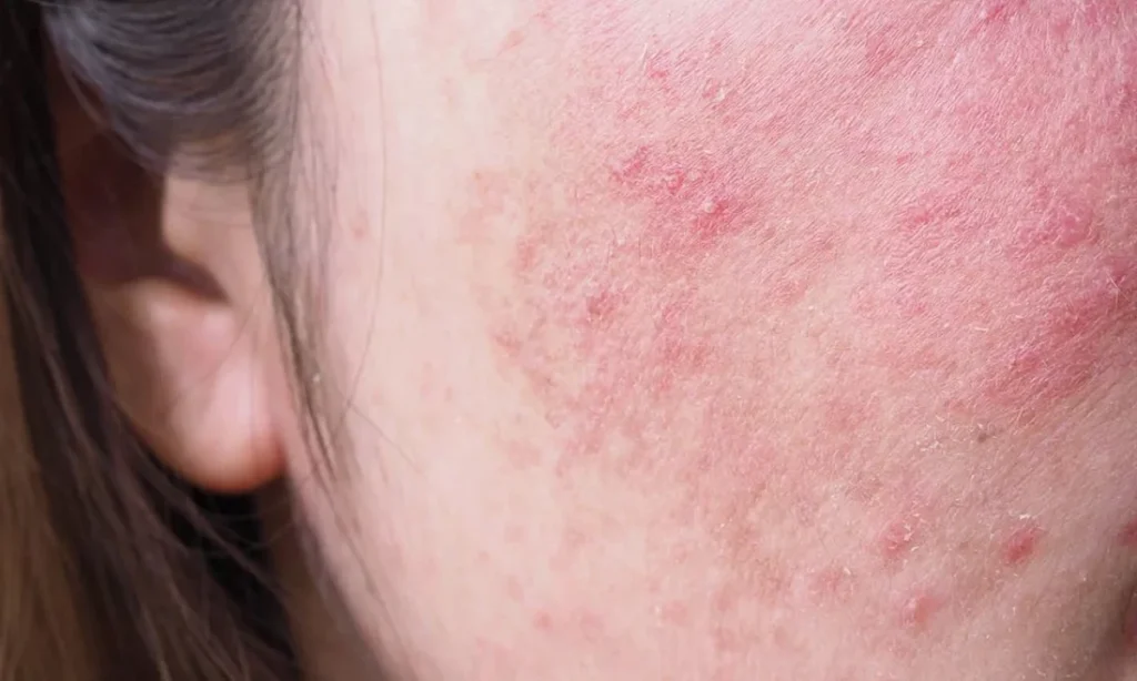 Why is my skin all of a sudden so sensitive? 8 Hidden Causes