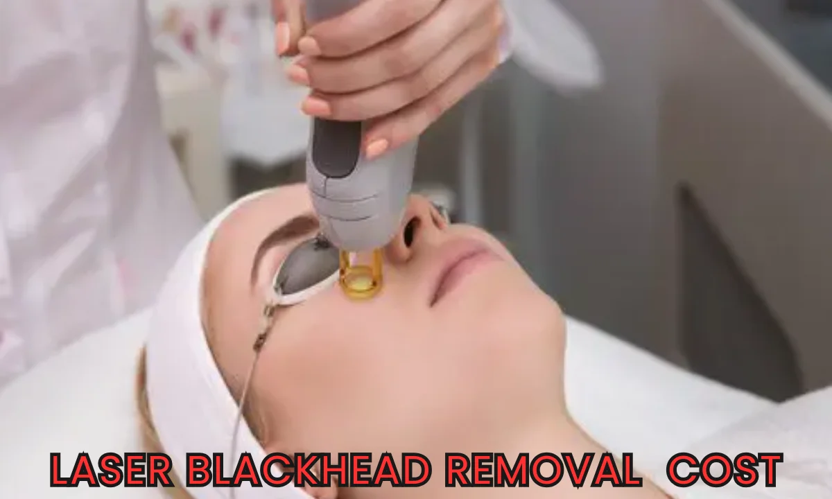 How much does laser blackhead removal cost in India? Top 3 Fcators