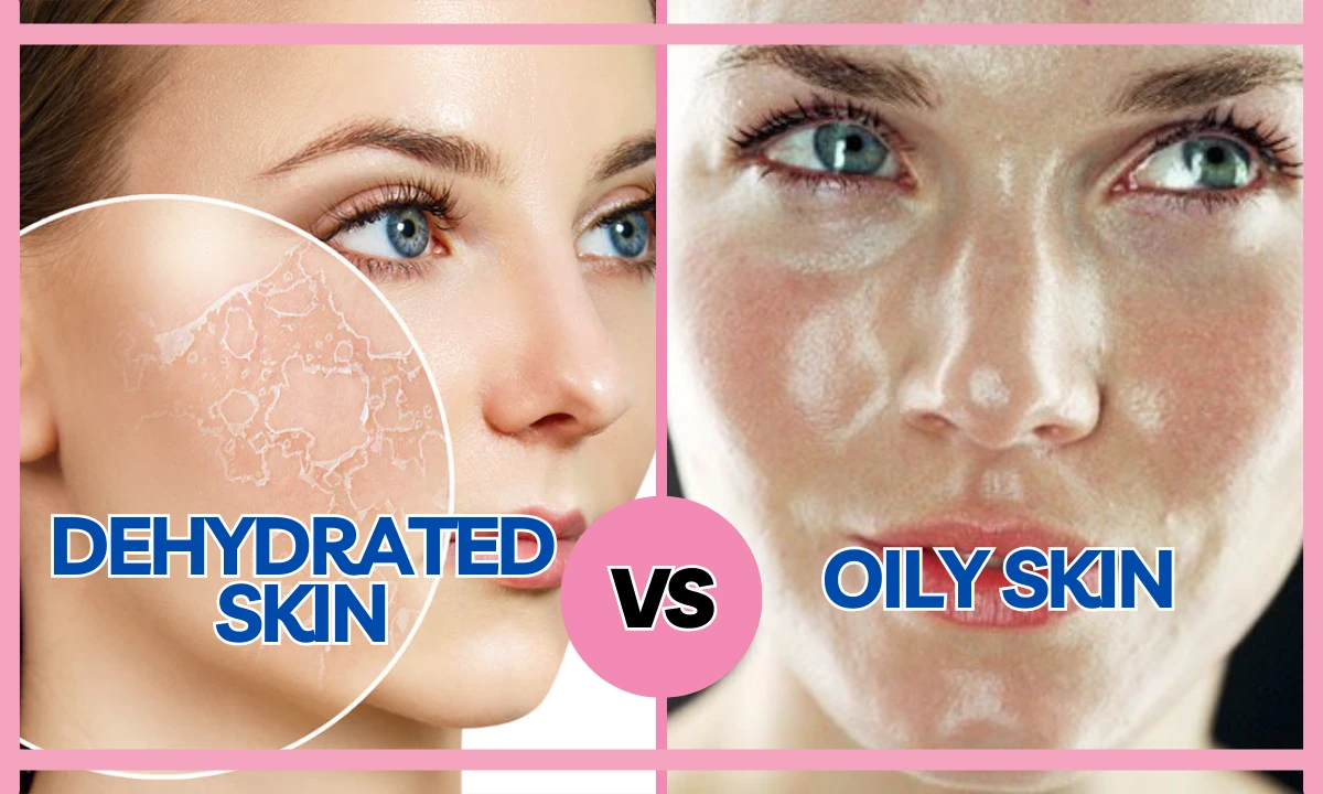 Is Oily Skin Dehydrated? 3 Signs You’re Missing