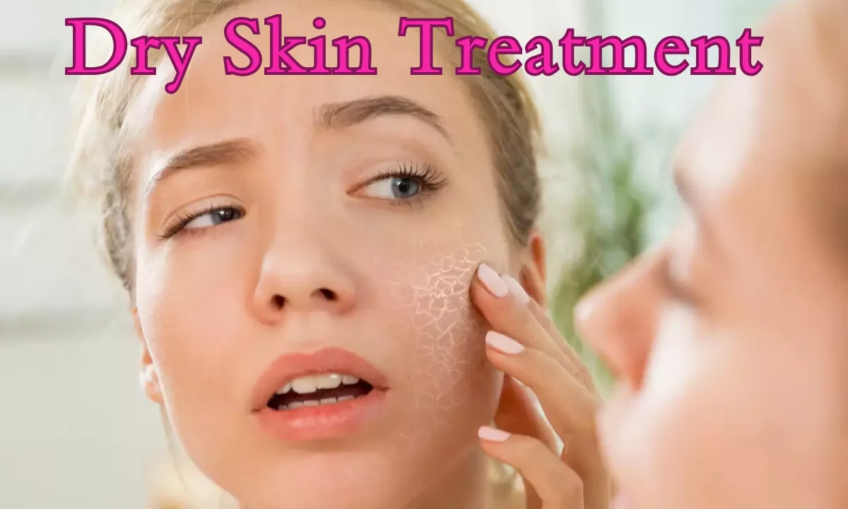 How Dry Skin Can Be Cured? 4 Proven Ways